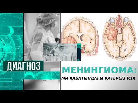 Бейне: Ми ісігі қан анализінде көрінеді ме?