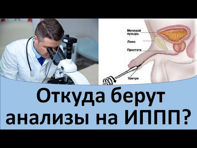 ПЦР-соскоб из уретры у мужчин ПЦР-соскоб из уретры у мужчин