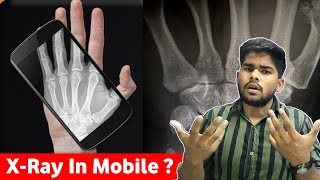 [Hindi] Best Real X-Rays Body Scanner App For Android | Download X-Ray App | Cloth Removing App screenshot 3