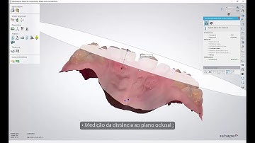 3. 3Shape Ortho Analyzer - Diagnóstico digital