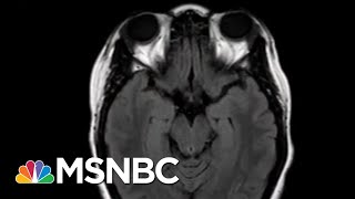 COVID-19 Is Affecting Kids' Brains Leaving Troubling Side Effects | The 11th Hour | MSNBC