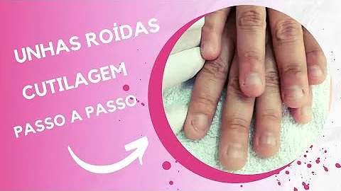 Como parar de roer unha e deixar crescer?