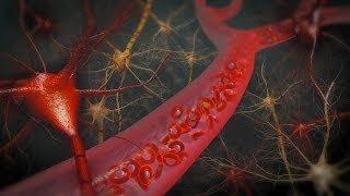 Neuronal Injury