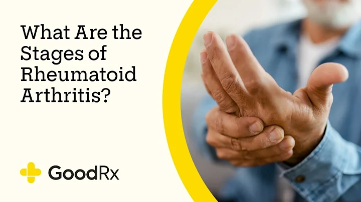 What Are the Stages of Rheumatoid Arthritis? | GoodRx