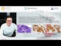 Заседание SPOT (Science & Practice in Oncology Training - наука и практика в обучении онкологии)