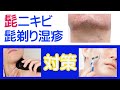 髭ニキビ(顎ニキビ・首ニキビ・フェイスラインニキビ)の対策~ニキビ専門「こことみ」