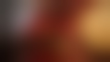 END-TO-SIDE MICROANASTOMOSIS - Common carotid artery in rat