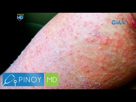 Video: Ano ang tawag sa mga tumutubo sa mga puno?