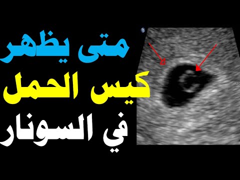 فيديو: كم من الوقت يظهر الحمل على الموجات فوق الصوتية