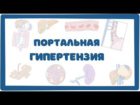 Видео: Портална хипертония - етиология, симптоми, диагностика, лечение