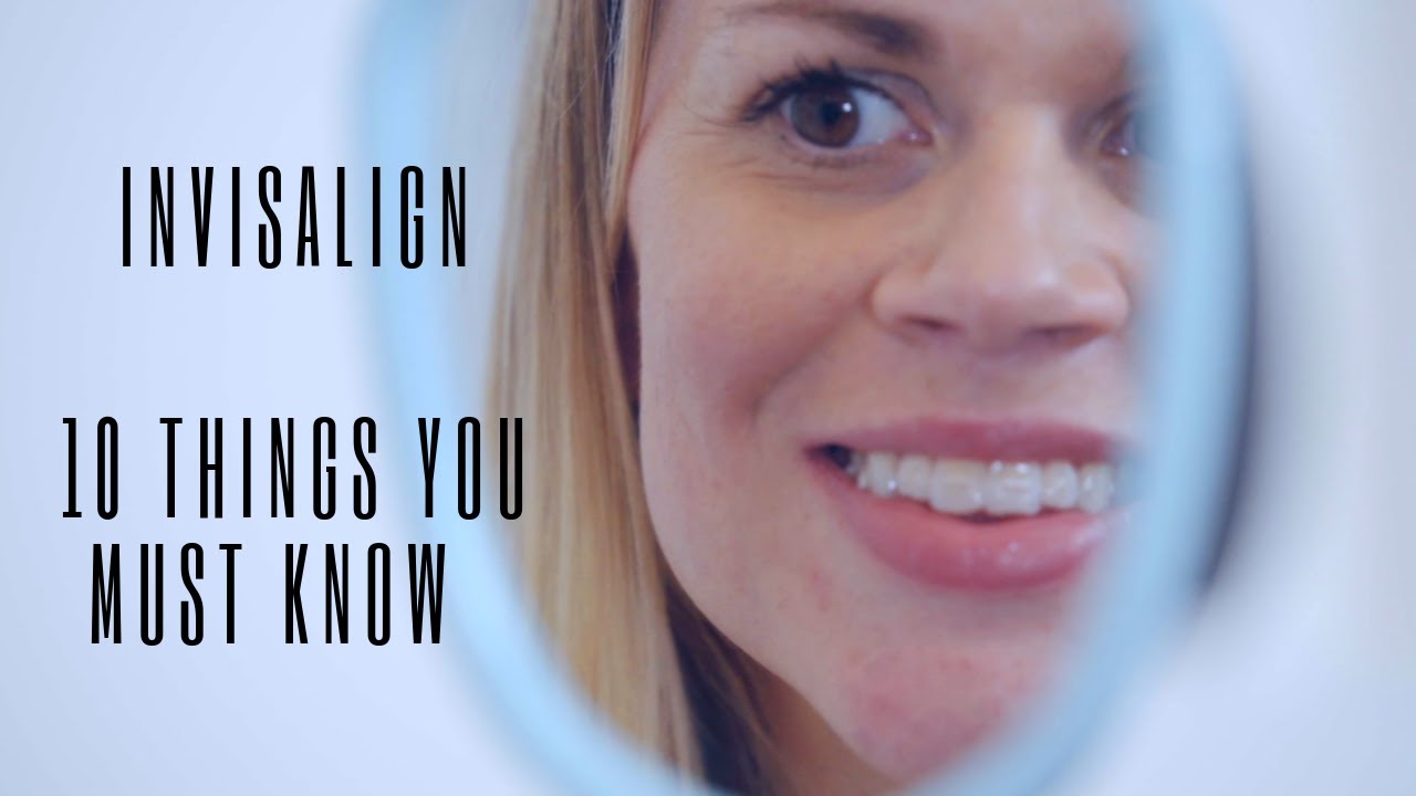 Invisalign-Must Know 10 Things