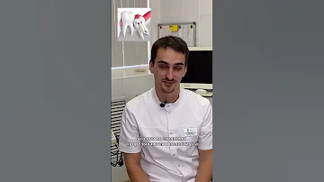 Почему зубы мудрости так называются