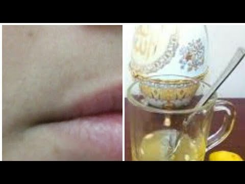 وصفة للتخلص من شعر فوق الشفايف واخضرار فوق الشفايف بمسحه واحده فقط مع خبيرة التجميل مريم يحيى