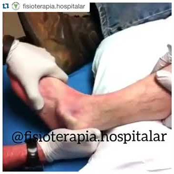 Especialista colocando el tobillo en su lugar despues de una lesion