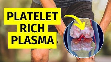 The Truth About PRP Injections For Knee Arthritis: What You Need to Know