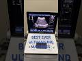 DEMO best D8 ultrasound machines incomparable in imaging and price 7 Days money back guarantee