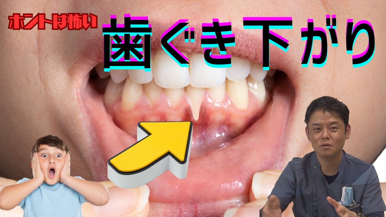 恐ろしい歯茎下がりとは？歯茎が下がらないためにできることを解説！