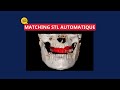 Tips  tricksmatching stl automatique