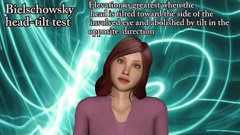 Trochlear nerve palsy - Cranial Nerve IV damage