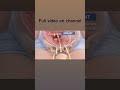 Mechanism of Labour Explained Simply | Nursing & Midwifery