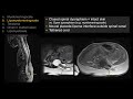 Neuroradiology Board Review - Pediatric Case 2