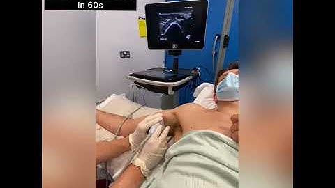 Axillary brachial plexus block