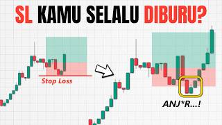 How to Determine the Right Stop Loss Zone