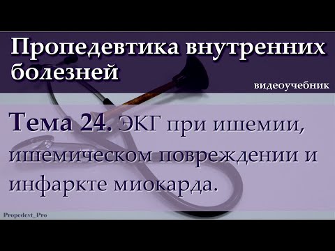 Тема 24. ЭКГ при ишемии, ишемическом повреждении и инфаркте миокарда.