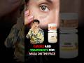 Understanding Milia: Causes, Prevention, and Treatment | How to Prevent and Treat Milia Effectively