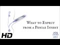 What To Expect From A Penile Insert