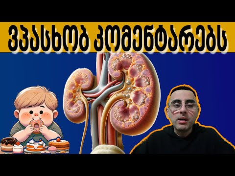 ტკბილი ტვინს ხომ ჭირდება და მაინც არ მივიღოთ? ვპასუხობ კომენტარებს