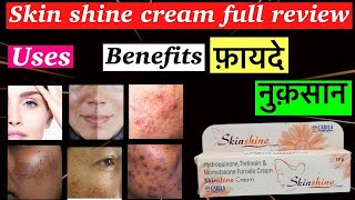 skin shine cream review | skin shine cream | skin shine cream uses | Benefits,Side effects,Hindi