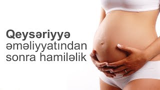 Qeysəriyyə əməliyyatından sonra hamiləlik - Mama-ginekoloqu - Aidə Hüseynova Resimi