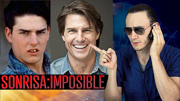 ¿Qué se ha hecho Tom Cruise en los dientes?