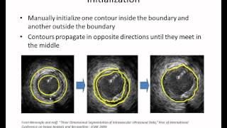 Famous EGGN 512 - Lecture 30-2 Deformable Models Net Worth