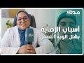 طبيبة مختصة توضح أسباب شلل الوجه النصفي وتحذر من أعراض تنذر بالإصابة به