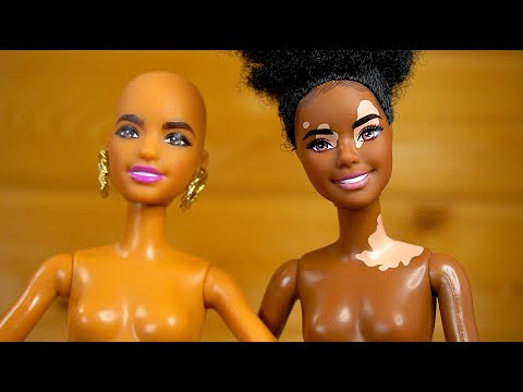 Витилиго и Лысая Барби Fashionistas
