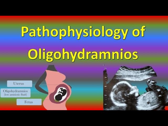 oligohydramnios case study scribd