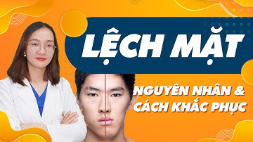 Lệch Mặt Là Gì | Nguyên Nhân Và Cách Khắc Phục | Nam Bùi Vinalign