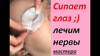 Фиксация МОРГАЮЩИХ глаз 2 популярных варианта