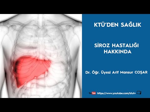 Siroz Nedir?