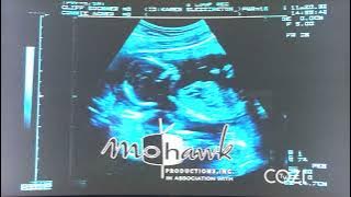 Fortis Productions/Mohawk Productions/Warner Bros. Television (2004) #1