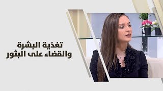 تغذية البشرة والقضاء على البثور - رند الديسي‬‎ - تغذية