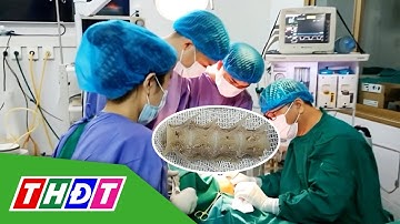 Hóc đoạn xương sống cá 4cm trong cổ, cụ ông 99 tuổi nguy kịch | THDT