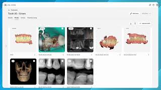 DS Core Plan Features - Treatment Space - Launch and manage treatments