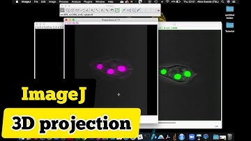 How to make 3D projection in ImageJ | 3D projection of microscope image in imageJ