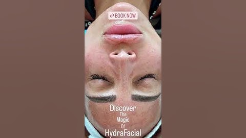 Unlock Radiant Skin with HydraFacial at EDEN AESTHETICS: Experience the Magic in Dubai!