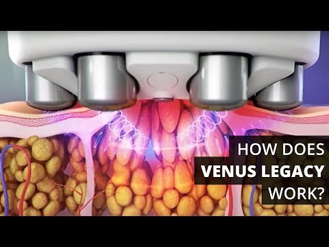 How Does Venus Legacy™ Work?