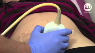 Download Lagu Chorzy na raka znajdują pomoc w internecie MP3