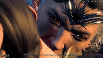 Astarion | Bite Scene - All Outcomes(no killing him) + Failed Dice Rolls | Baldur
